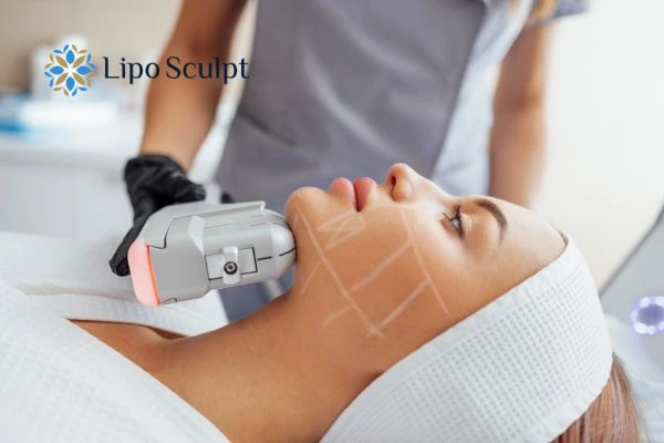 HIFU vs Botulinum Toxin: Understanding the Differences 1 HIFU vs Botox Brislington What is the best option for you?