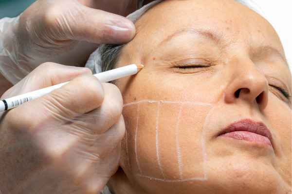 CryoPen: 5 Skin Concerns It May Be Used to Treat 4 What should you ask before having CryoPen treatment Brislington?